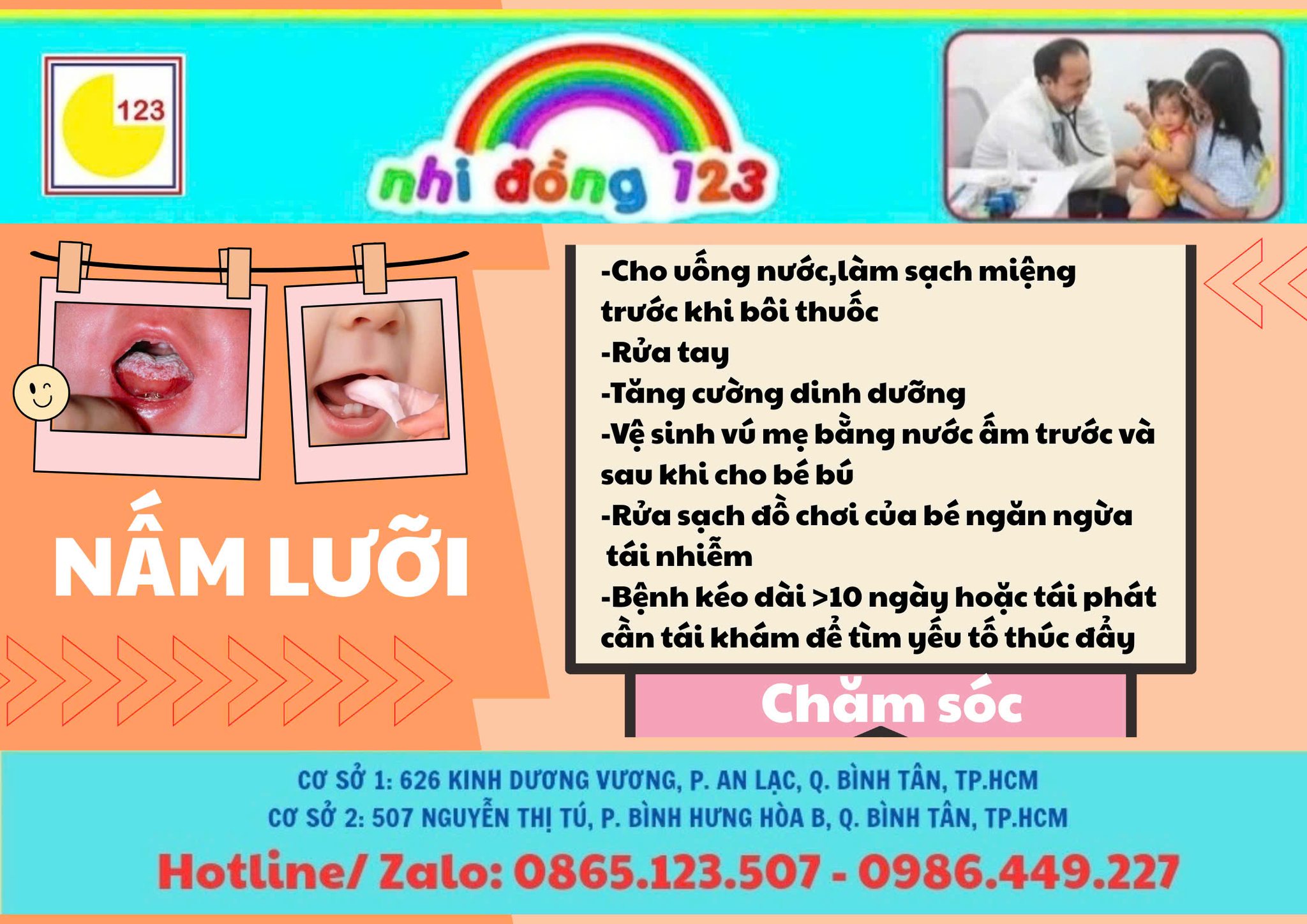 Nấm lưỡi trẻ em