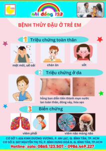 Thủy đậu trẻ em