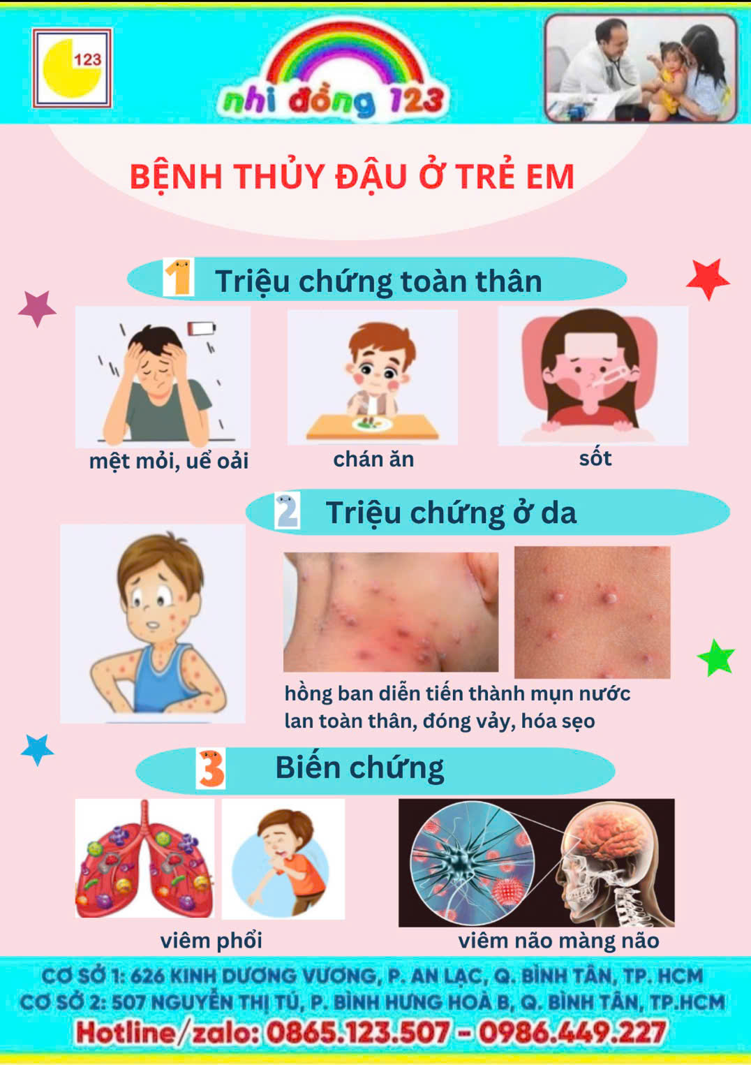 Thủy đậu trẻ em